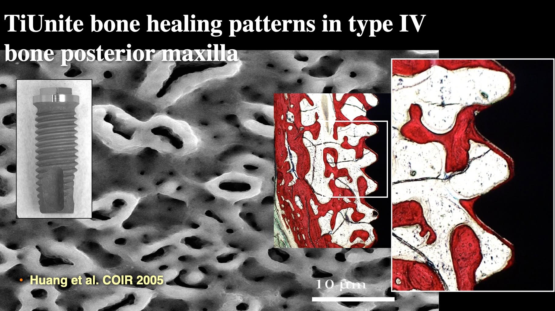 TiUnite 骨癒合研究與 Huang et al. COIR 2005