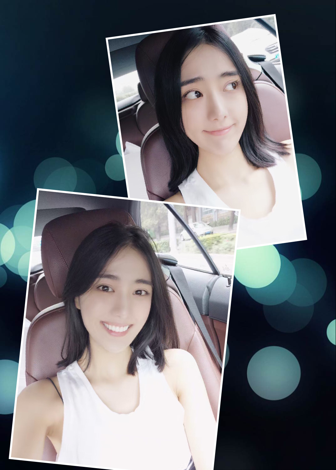 水雷射牙齦美學笑容案例拼貼