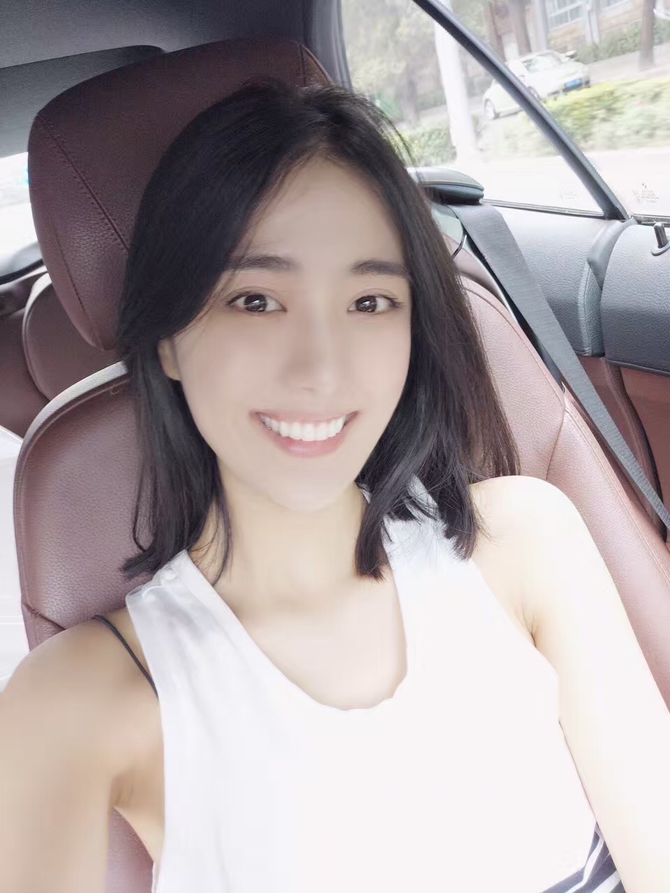 水雷射牙齦美學完成後笑容